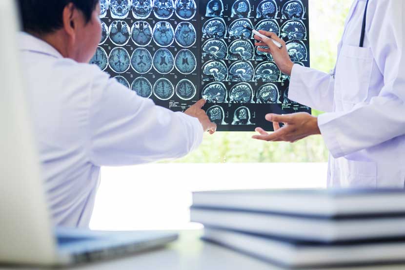 accident doctors explain head/brain injury